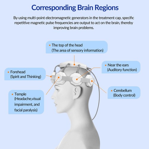 Repeated Transcranial Magnetic Stimulation Rtms Therapy for Depression Anxiety - Picture 4 of 13