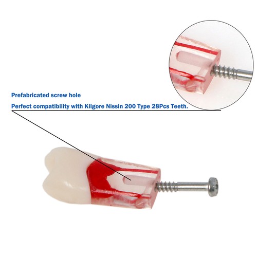 10 piezas modelo dental endodontal de conducto radicular estudio ECA práctica modelo #8006 - Imagen 32 de 80