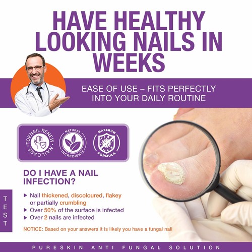 Pilz Zehennagelpilz Fußpilze Nagelbehandlung Pflege - Bild 4 von 7