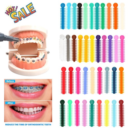 1040 piezas Corbatas de ligadura de ortodoncia dental Bandas de goma elásticas color mixto - Imagen 5 de 6