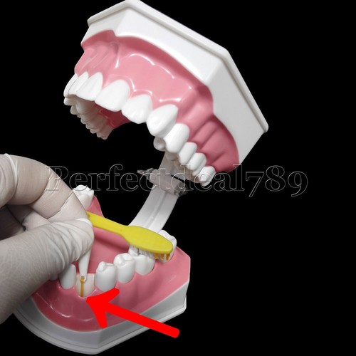 Dental Orthodontics Implant Study Model Analysis Demonstration Tooth Teaching - Picture 103 of 158