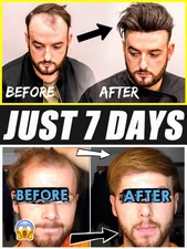 Gᴇɴᴛʟᴇ ᴀɴᴅ Ʀᴇғʀᴇsʜɪɴɢ, ᴇᴀsɪʟʏ ᴀʙsᴏʀʙᴇᴅ,ᴘʀᴏᴍᴏᴛᴇs ᴛʜᴇ ɢʀᴏᴡᴛʜ ᴏғ ɴᴇᴡ ʜᴀɪʀ.