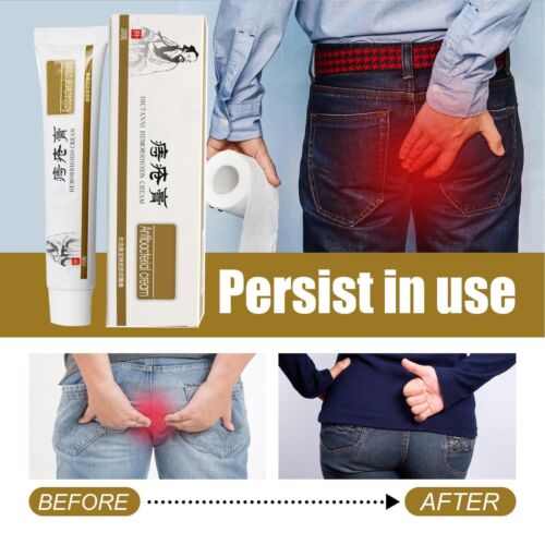 2PCS Hämorrhoiden Salbe, Chinesische Pflanzliche Hämorrhoiden-Creme Zäpfchen - Bild 6 von 7