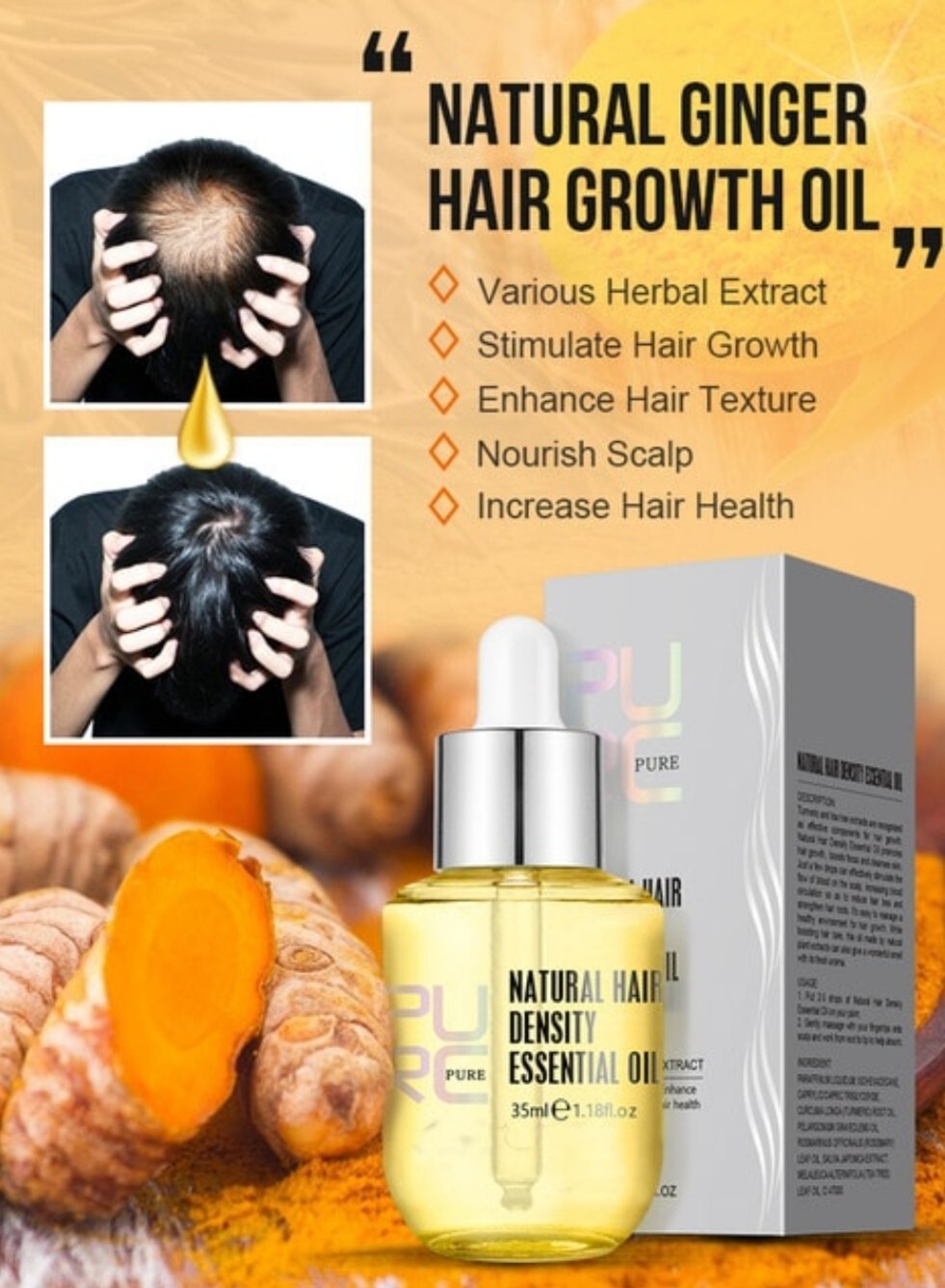 Natural Ginger Hair Growth Oil Thickener Essence Anti Hairs Loss Care Scalp | eBay Natural Ginger Hair Growth Oil Thickener Essence Anti Hairs Loss Care Scalp | eBay