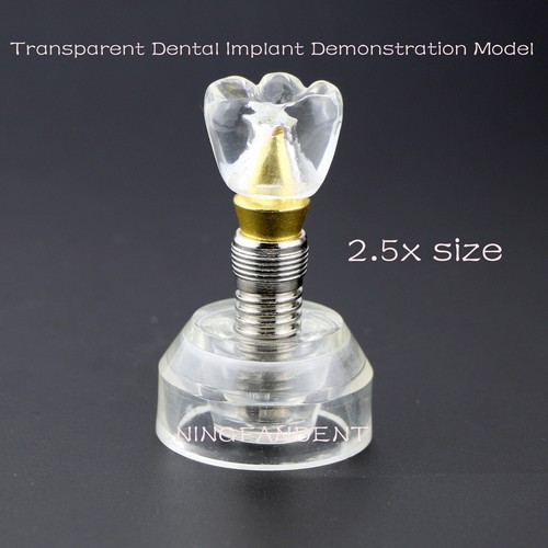 Dental Implant Model Upper Lower Jaw Demo All on 4/6 Overdenture treatment model - Picture 209 of 214
