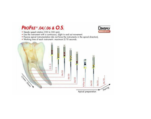 Dentsply Maillefer Zahnprofil ISO 25mm 0,04 konische Drehfeilen 6/Pack alle Größen - Bild 6 von 6