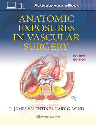 Anatomic Exposures in Vascular Surgery | Gary G. Wind, James Valentine