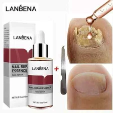 Lanbena Nail Repair Essence Fingernail & Toenail Repair Nail Treatment 0.5fl.oz