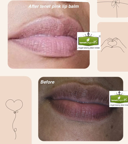 Pink lips Balm Set ( very Effective) 30g And Lip Scrub Smells Delicious ππ - Picture 1 of 15
