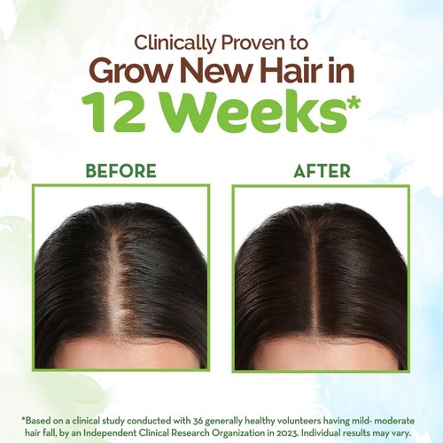 Mamaearth Rosemary Hair Growth Oil Rosemary & Methi Dana Promoting Hair Growth - Picture 6 of 8