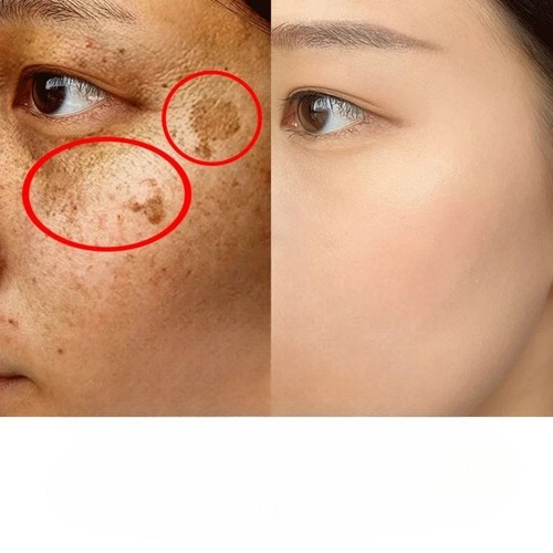 Loción corporal blanqueadora con ácido kójico crema iluminadora de la piel, 15 oz [Stock de EE. UU. 🇺🇸] - Imagen 5 de 19