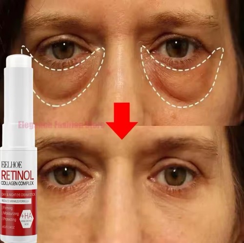 Instant Eye Bag Remove Eye Cream anti Fat Particles Dark Circles Puffiness Fade - Picture 5 of 7