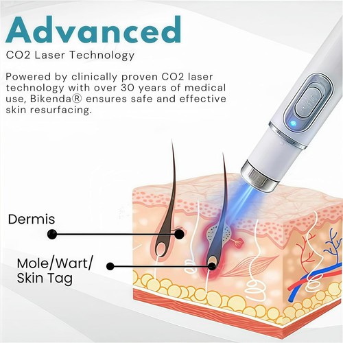 Non-Invasive Mole and Wart Removal Pen, Mole and Wart Removal Laser Pen - Imagen 3 de 5