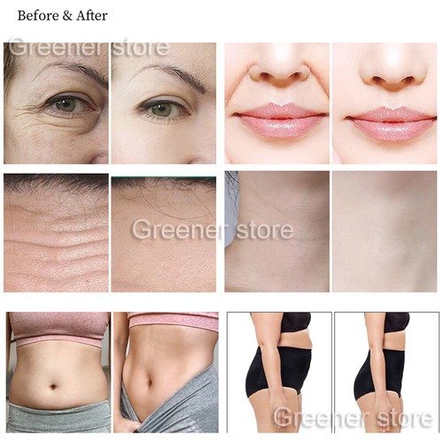7D Facial Eye Care Beauty Machine Skin Firming Body Shape Slimming Anti Aging - Picture 9 of 13