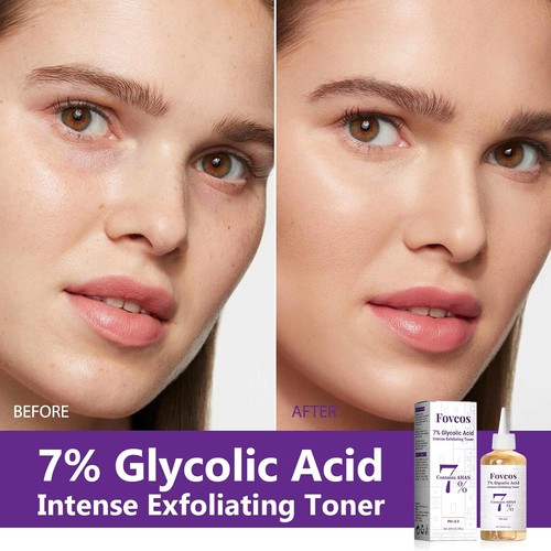 7% Glycolic Acid Toner - Exfoliates Improves Texture - Picture 4 of 28