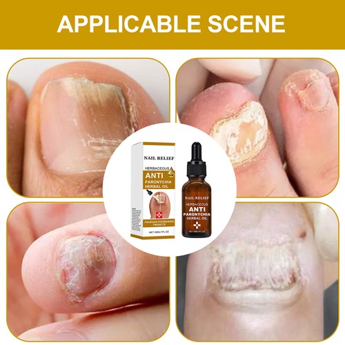 Toe Nail Softener 1.05oz Foot Nail Soothing Oil Foot Thick Nails proficient - Picture 4 of 11