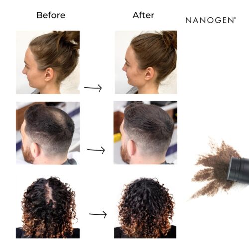 Fibre ispessienti per capelli marrone scuro 30 grammi - Foto 7 di 8