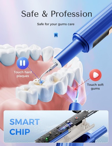 Removedor de placa para dientes - Removedor de sarro para dientes Removedor de cálculo dental D... - Imagen 3 de 7