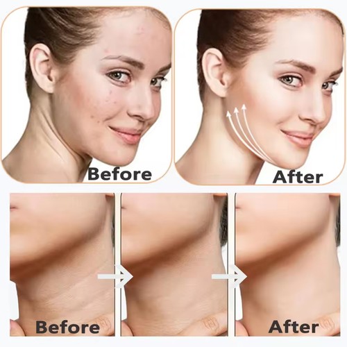 Máquina de belleza LED microcorriente cuello estiramiento facial lifting dispositivo facial para la piel - Imagen 18 de 22