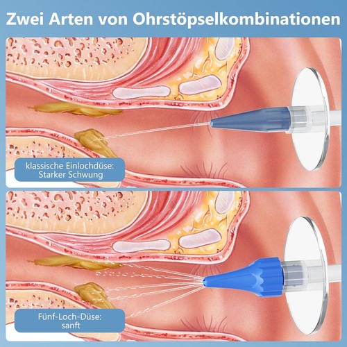 Ohrenreiniger Ohrenschmalz Entferner, VITCOCO Ohrreiniger für Erwachsene Mit 9+1 - Bild 6 von 7