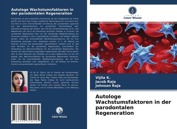Autologe Wachstumsfaktoren In Der Parodontalen Regeneration Vijila K.-image