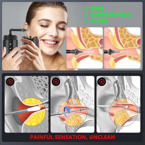 Water Powered Ear Cleaner - Ear Wax Removal Tool - Earwax Washer Lavage Kit US - Picture 14 of 18