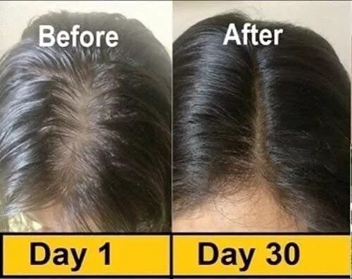 200 Capsules x Evion 400mg Capsule with Vitamin E Healthy Skin Hair Health FS - Picture 6 of 8
