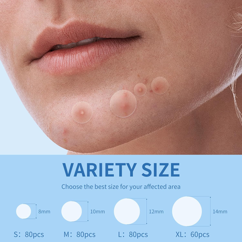 Pimple Patches for Face, 4 Size 300 Counts Acne Patches, Hydrocolloid Patches fo - Picture 3 of 12