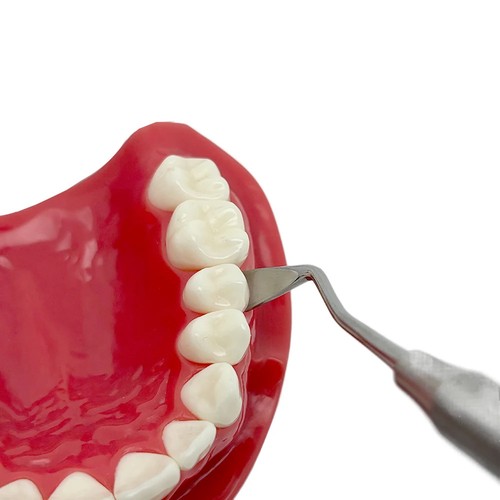 Dental Implant Gingival Retractor Gum Separator Surgical Tool for Precise - Bild 5 von 6