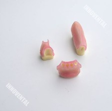 Dental Model #2003 06 - Replaceable Bone Modules for #2003 01