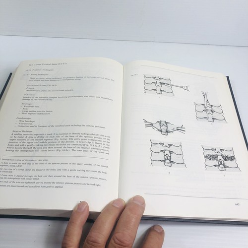 3RD EDITION Manual of Internal Fixation Techniques Recommended by the AO-ASIF - Picture 13 of 17