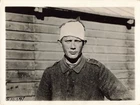 Wounded German Prisoner 1918 Press Photo France WW1 World War 1 *P184c
