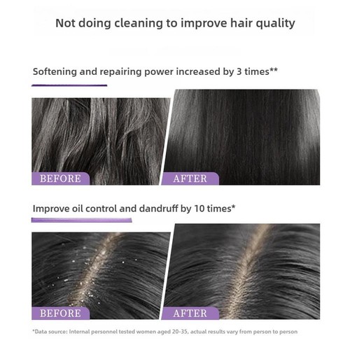 Selenium Disulfide Anti-Dandruff Shampoo Fluffy Scalp Men's Shampoo Hot - Picture 6 of 10
