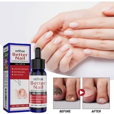 Nail Fungus Treatment Liquid with Moisturizing Formula for Toenail Health