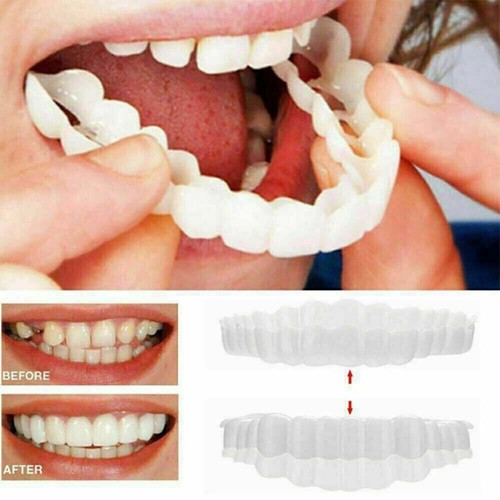 Dentición prótesis dental cosmética prótesis prótesis dentales dientes falsos artificiales/ - Imagen 1 de 21