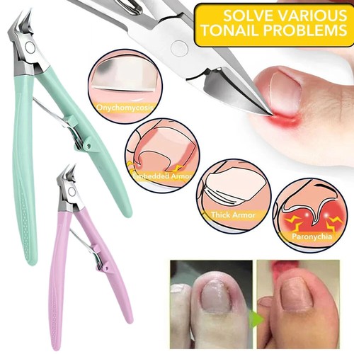 Schneider Des Inkarnierten Nagels Paronychia Bupile Nagelschere Nagel Nipper ↑