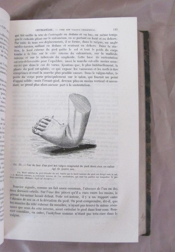 1878 ANTIQUE FRENCH MEDICAL HARDCOVER BOOK – SURGERY VOL.25 - Picture 7 of 10