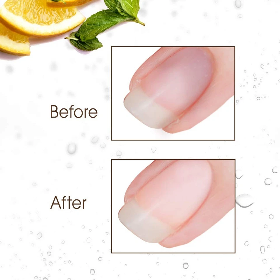 Gena Nail Brite Whitening Scrub with Brush, Cleans Conditions & Brightens Nai... - Image 3 of 4