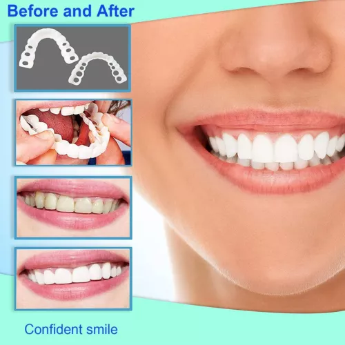 Set superiore e inferiore a scatto denti finti faccette dentali protesi copertura denti US - Foto 12 di 12