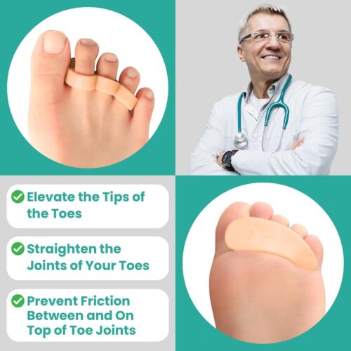 Hammertoe Corrector Gel Toe Straighteners - 8 Pcs Toe Support Pads Cushion - ... - Picture 3 of 7