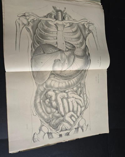 Antique 1884 Pathological Anatomy Diseases of Human Body J. A. Jeancon Progress - Bild 20 von 23