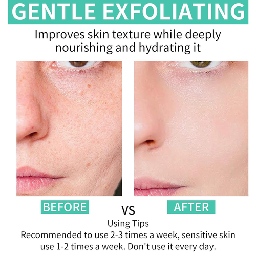 35% Glycolic Acid Pads for Face & Body Exfoliant,Exfoliating Face Pad with AHA, - Picture 5 of 12