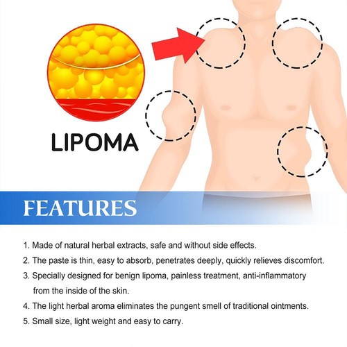 20g Lipoma Soothing Cream Instant Ointment RelievingDiscomfort Fat Agglomerat - Picture 13 of 13
