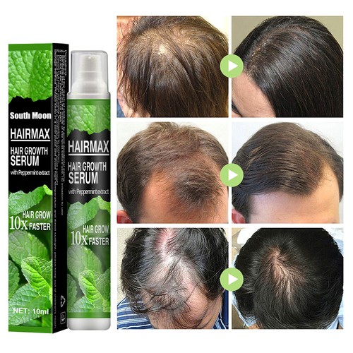 Herbal Thickening Spray Stylist Recommended Hair Booster Products for Women Men | eBay Herbal Thickening Spray Stylist Recommended Hair Booster Products for Women Men | eBay