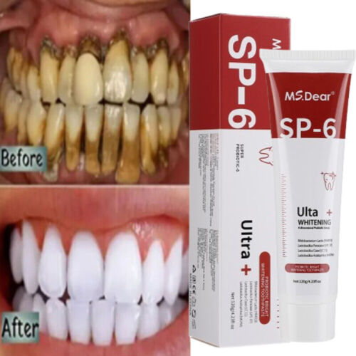 2-Pack SP-6 Probiotic Toothpaste: Whitening + Brightening with Fresh Breath Care - Picture 3 of 22