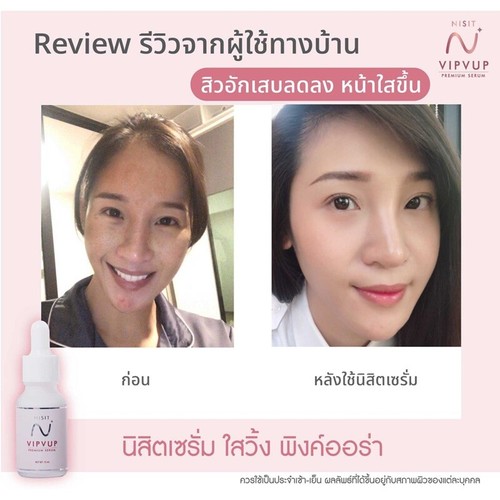 10 pcs. Nisit Serum Brighten Skin Reduce Blemish Shine Bright DHL Express - Picture 6 of 12