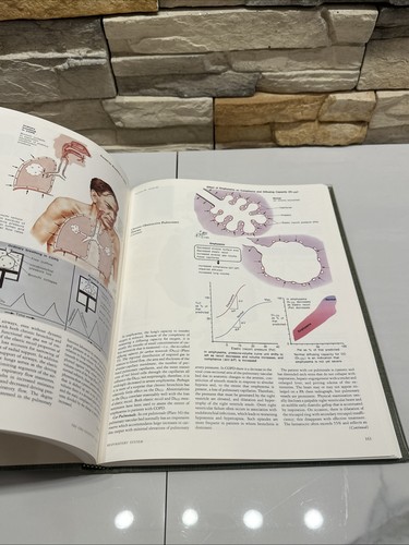 The CIBA Collection of Medical Illustrations Volume 7 Respiratory System - Picture 17 of 22