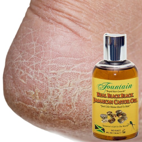 Aceite de ricino negro jamaicano orgánico para curación multiusos y crecimiento rápido del cabello  - Imagen 2 de 8