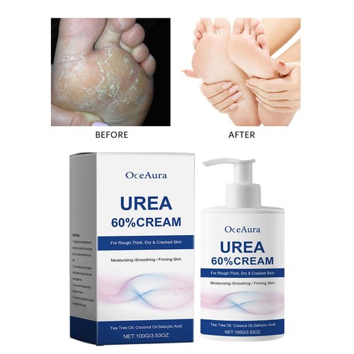 Urea Cream 60% Foot Cream Cracked Heel Repair Cream Callus Treatment Cream 100 g - Bild 3 von 17