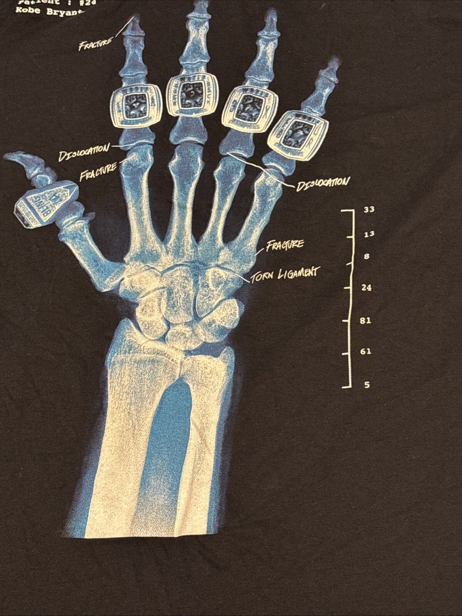 Nike Kobe Mens X-ray Fracture Finger 5 Rings Lakers Broken